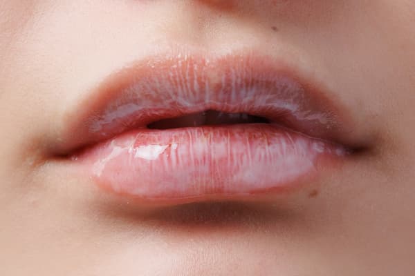 涂抹后立即（乳白色）