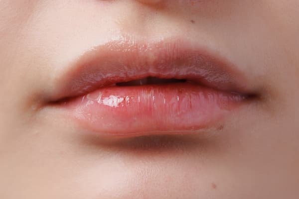 After absorption (transparent)